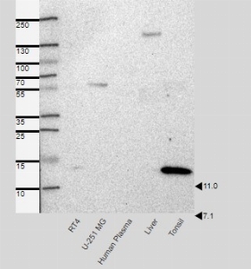 Click to enlarge image Results provided by the Human Protein Atlas (www.proteinatlas.org). Band of predicted size in kDa (+/-20%) with additional bands present. Analysis performed using a standard panel of samples. Antibody dilution: 1:500.