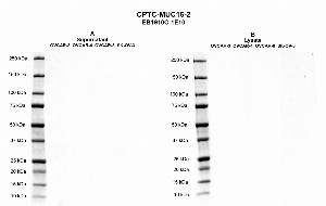 Click to enlarge image Western blot using CPTC-MUC16-2 as primary antibody against cell culture supernatants OVCAR-3 (lane 2), OVCAR-4 (lane 3), OVCAR-8 (lane 4), and SK-OV-3 (lane 5) (Panel A) and against cell lysates OVCAR-3 (lane 2), OVCAR-4 (lane 3), OVCAR-8 (lane 4), and SK-OV-3 (lane 5) (Panel B). Molecular weight standards are also included in each panel (lane 1). Expected molecular weight > 250 kDa.