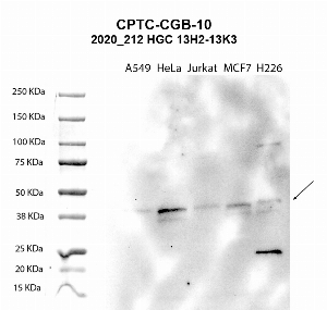 Click to enlarge image Western blot using CPTC-CGB-10 as primary antibody against A549 (lane 2), HeLa (lane 3), Jurkat (lane 4), MCF7 (lane 5), and H226 (lane 6) whole cell lysates.  Expected molecular weight - 17 kDa.  Molecular weight standards are also included (lane 1). Blot was developed using enhanced chemiluminescence (ECL).