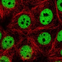 Click to enlarge image Results provided by the Human Protein Atlas (www.proteinatlas.org). The subcellular location is supported by literature. Immunofluorescent staining of human cell line MCF7 shows localization to nucleoplasm. Human assay: HeLa fixed with PFA, dilution: 1:2000
Human assay: MCF7 fixed with PFA, dilution: 1:2000
Human assay: U-2 OS fixed with PFA, dilution: 1:2000