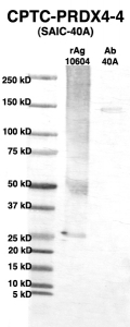 Click to enlarge image Western Blot using CPTC-PRDX4-4 as primary Ab against full-length recombinant Ag 10604 (lane 2). Also included are molecular wt. standards (lane 1) and the PRDX4-4 Ab as positive control (lane 3).