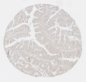 Click to enlarge image Tissue Micro-Array (TMA) core of colon cancer showing cytoplasmic staining using Antibody CPTC-PSMB10-1. Titer: 1:1000