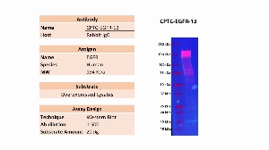 点击放大图像，使用CPTC-EGFR-13在过度表达的裂解液中重组EGFR的Western blot。抗体能够检测目标蛋白。预计MW为134 KDa。