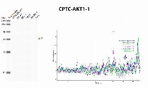 Click to enlarge image Automated western blot using CPTC-AKT1-1 as primary antibody against whole lysates of cell lines MDA-MB-231, HT-29, MCF7, T47D, SK-OV-3, and HeLa. The antibody cannot recognize the target in the cell lysates.