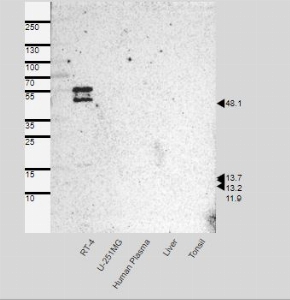 Click to enlarge image Results provided by the Human Protein Atlas (www.proteinatlas.org). Band of predicted size in kDa (+/-20%) with additional bands present.
Analysis performed using a standard panel of samples. Antibody Dilution 1:500