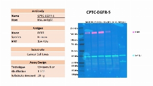 Click to enlarge image Western blot using CPTC-EGFR-5 as primary antibody against the whole cell lysates of A498, ACHN, H226, H322M, CCRF-CEM and HL-60. The antibody is able to detect the target protein in the cell lines A498, ACHN, H226 and H322M. Expected MW is 134 KDa. The same membrane was probed with an anti-Vinculin antibody. Vinculin was detected in  A498, ACHN, H226 and H322M, and weakly in CCRF-CEM and HL-60.