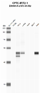 Click to enlarge image Automated western blot using CPTC-IFIT2-1 as primary antibody against PBMC (lane 2), HeLa (lane 3), Jurkat (lane 4), A549 (lane 5), MCF7 (lane 6), and NCI-H226 (lane 7) whole cell lysates.  Expected molecular weight - 54.6 kDa.  Molecular weight standards are also included (lane 1). HeLa, Jurkat, and NCI-H226 cell lines are positive. All other cell lines are negative.