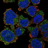 Click to enlarge image Results provided by the Human Protein Atlas (www.proteinatlas.org). The subcellular location is partly supported by literature or no literature is available. Immunofluorescent staining of human cell line THP-1 shows localization to vesicles. Human assay: THP-1 fixed with PFA, dilution: 1:100 Human assay: U2OS fixed with PFA, dilution: 1:100