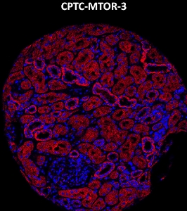 Click to enlarge image Imaging mass cytometry on normal kidney tissue core using CPTC-MTOR-3 metal-labeled antibody.  Data shows an overlay of the target protein signal (red) and DNA (blue). Dilution: 1:100 of 0.5mg/mL stock. Signal was also obtained in other normal tissues (liver, bone marrow, spleen, placenta, prostate, colon, pancreas, breast, lung, testis, endometrium, and appendix) and cancer tissues (breast, prostate, colon, ovarian, and lung).