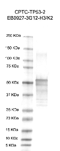 Click to enlarge image Western Blot using CPTC-TP53-2 as primary antibody against recombinant human tumor protein p53 (TP53), transcript variant 1 (lane 2). Also included are molecular weight standards (lane 1).