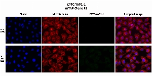 Click to enlarge image Immunofluorescence staining using CPTC-YAP1-1 as primary antibody (green) against A549 and SF-268 cells. A549 cells show no localization of the YAP1 protein. SF-269 show localization of the YAP1 protein in the cytoplasma and the nucleus