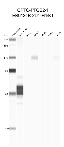 Click to enlarge image Automated western blot using CPTC-PTGS2-1 as primary antibody against buffy coat (lane 2), HeLa (lane 3), Jurkat (lane 4), A549 (lane 5), MCF7 (lane 6), and H226 (lane 7) cell lysates.  Expected molecular weight - 95 kDa.  Molecular weight standards are also included (lane 1). Data is positive for Jurkat and H226 cell lines. Data is negative/inconclusive for remaining cell lines.
