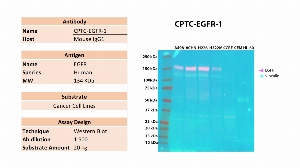 Click to enlarge image Western blot using CPTC-EGFR-1 as primary antibody against the whole cell lysates of A498, ACHN, H226, H322M, CCRF-CEM and HL-60. The antibody is able to detect the target protein in the cell lines A498, ACHN, H226 and H322M. Expected MW is 134 KDa. The same membrane was probed with an anti-Vinculin antibody. Vinculin was detected in  A498, ACHN, H226 and H322M, and weakly in CCRF-CEM and HL-60.