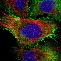 Click to enlarge image Results provided by the Human Protein Atlas (www.proteinatlas.org). The subcellular location is supported by literature. Immunofluorescent staining of human cell line U-2 OS shows localization to plasma membrane. Human assay: A-431 fixed with PFA, dilution: 1:2000
Human assay: U-2 OS fixed with PFA, dilution: 1:2000
Human assay: U-251 MG fixed with PFA, dilution: 1:2000