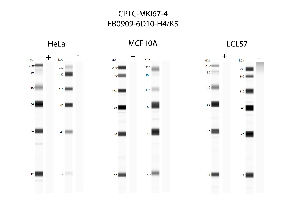 Click to enlarge image Automated western blot using CPTC-MKI67-4 as primary antibody against cell lysates HeLa, MCF10A, and LCL57.  Samples from each cell line were irradiated with 10 Gy as shown in ‘+’ indicated lanes. Samples from each non-irradiated cell line were treated with alkaline phosphatase enzyme as shown in ‘-‘ indicated lanes.  Molecular weight standards are included for each cell line.