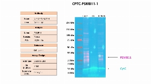 Click to enlarge image Western Blot using CPTC-PSMB11-1 as primary antibody against the cell lysates of mouse thymus (EL4.IL2), mouse lymphoma cells (EL4), and human Thymus cells (Hs.202.Th). The antibody does not recognize the target protein in the tested lysates.  The same cell lysates were also probed for Cytochrome C, which was detected at different level of expression in each tested cell.