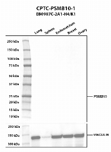 Click to enlarge image Western blot using CPTC-PSMB10-1 as primary antibody against human lung (2), spleen (3), endometrium (4), breast (5), and ovary (6) tissue lysates. The expected molecular weight is 28.9 kDa. Vinculin was used as a loading control.