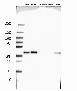 Click to enlarge image Results provided by the Human Protein Atlas (www.proteinatlas.org). Single band corresponding to the predicted size in kDa (+/-20%). Analysis performed using a standard panel of samples. Antibody dilution: 1:500