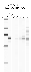 Click to enlarge image Automated western blot using CPTC-MSH2-1 as primary antibody against buffy coat (lane 2), HeLa (lane 3), Jurkat (lane 4), A549 (lane 5), MCF7 (lane 6), and H226 (lane 7) cell lysates.  Expected molecular weight - 105 kDa.  Molecular weight standards are also included (lane 1). Data is negative/inconclusive.