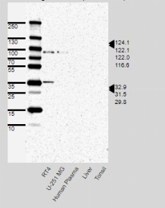 Click to enlarge image Results provided by the Human Protein Atlas (www.proteinatlas.org). Band of predicted size in kDa (+/-20%) with additional bands present. Analysis performed using a standard panel of samples. Antibody dilution: 1:500.