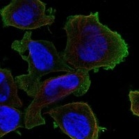 Click to enlarge image Results provided by the Human Protein Atlas (www.proteinatlas.org). The subcellular location is partly supported by literature or no literature is available. Immunofluorescent staining of human cell line THP-1 shows localization to plasma membrane.

	
Human assay: THP-1 fixed with PFA, dilution: 1:200
Human assay: U2OS fixed with PFA, dilution: 1:200