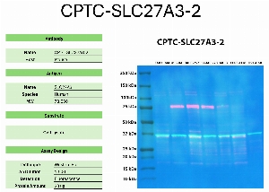 Click to enlarge image Western blot using CPTC-SLC27A3-2 as primary antibody against the whole lysates of U-87, MALME-3M, UACC-257, SK-MEL-28, MCF7, CCRF-CEM, and OVCAR-8. The antibody detected the target protein (~73.5 KDa) in MALME-3M, UACC-257, SK-MEL-28, and MCF7 cell lysates.