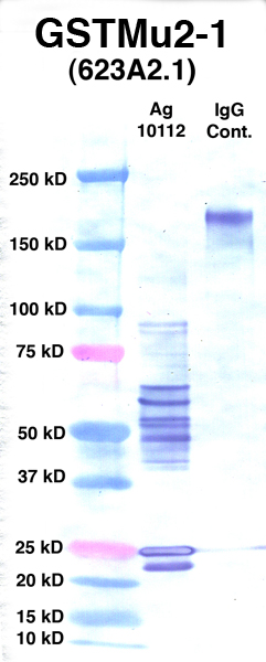 Click to enlarge image Western Blot using CPTC-GSTMu2-1 as primary Ab against Ag 10112 (lane 2). Also included are molecular wt. standards (lane 1) and mouse IgG control (lane 3).