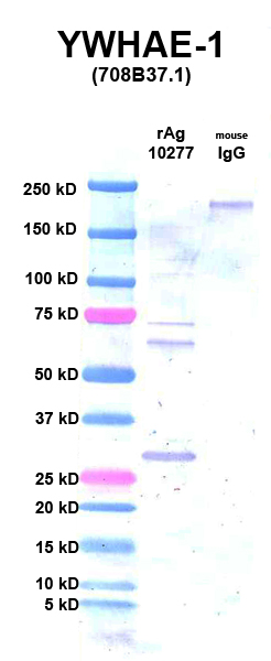 Click to enlarge image Western Blot using CPTC-YWHAE-1 as primary Ab against rYWHAE Ag (NCI-10277) in lane 2. Also included are molecular wt. standards (lane 1) and mouse IgG control (lane 3).
