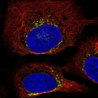 Click to enlarge image Results provided by the Human Protein Atlas (www.proteinatlas.org).  The subcellular location is supported by literature. Immunofluorescent staining of human cell line U-2 OS shows localization to the Golgi apparatus. Human assay: HeLa fixed with PFA, dilution: 1:2000
Human assay: MCF7 fixed with PFA, dilution: 1:2000
Human assay: U-2 OS fixed with PFA, dilution: 1:2000