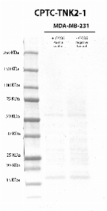 Click to enlarge image Western Blot usign CPTC-TNK2-1 as primary antibody against cell lysates of MDA-MB-231 cells treated (lane 2) and not treated (lane 3) with EGF (100 ng/mL0 for 10 minutes, after overnight starvation. Molecular weight standards are also included (lane 1). The antibody was not able to detect  the not phosphorylated and/or phosphrylated target protein in the EGF treated and not treated cell lysate. Expected molecultar weight for TNK2 is about 114 KDa.