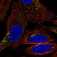 Click to enlarge image Results provided by the Human Protein Atlas (www.proteinatlas.org). The subcellular location is supported by literature. Immunofluorescent staining of human cell line U-2 OS shows localization to the Golgi apparatus. Human assay: HeLa fixed with PFA, dilution: 1:2000
Human assay: MCF7 fixed with PFA, dilution: 1:2000
Human assay: U-2 OS fixed with PFA, dilution: 1:2000