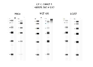 Click to enlarge image Automated western blot using CPTC-CHEK2-1 as primary antibody against cell lysates HeLa, MCF10A, and LCL57.  Samples from each cell line were irradiated with 10 Gy as shown in the ‘+’ indicated lanes. Samples from each non-irradiated cell line were treated with alkaline phosphatase enzyme as shown in the ‘-‘ indicated lanes. Molecular weight standards are also included for each cell line.