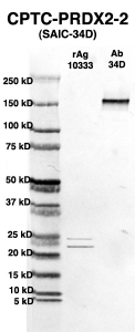 Click to enlarge image Western Blot using CPTC-PRDX2-2 as primary Ab against full-length recombinant Ag 10333 (lane 2). Also included are molecular wt. standards (lane 1) and the PRDX2-2 Ab as positive control (lane 3).