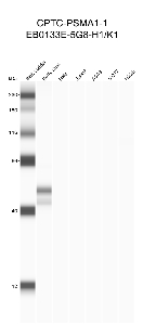 Click to enlarge image Automated western blot using CPTC-PSMA1-1 as primary antibody against buffy coat (lane 2), HeLa (lane 3), Jurkat (lane 4), A549 (lane 5), MCF7 (lane 6), and H226 (lane 7) cell lysates.  Expected molecular weight - 29 kDa.  Molecular weight standards are also included (lane 1). Data are negative/inconclusive for all cell lines.