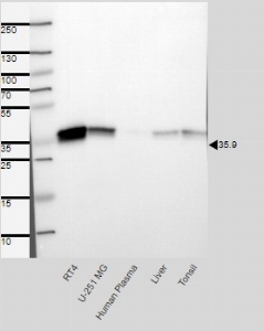 Click to enlarge image Results provided by the Human Protein Atlas (www.proteinatlas.org). Single band corresponding to the predicted size in kDa (+/-20%).  Analysis performed using a standard panel of samples.  Antibody dilution: 1:500