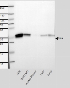 点击放大图片人类蛋白质图谱（www.proteinatlas.org）提供的结果。与预测大小相对应的单波段，单位为kDa（+/-20%）。使用标准样品面板进行分析。抗体稀释度：1:500