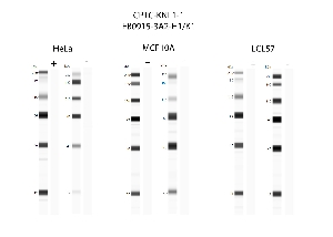 Click to enlarge image Automated western blot using CPTC-KNL1-1 as primary antibody against cell lysates HeLa, MCF10A, and LCL57.  Samples from each cell line were irradiated with 10 Gy as shown in ‘+’ indicated lanes. Samples from each non-irradiated cell line were treated with alkaline phosphatase enzyme as shown in ‘-‘ indicated lanes.  Molecular weight standards are included for each cell line.