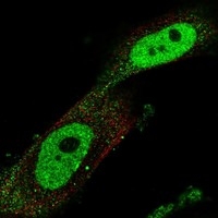 Click to enlarge image Results provided by the Human Protein Atlas (www.proteinatlas.org). The subcellular location is supported by literature. Immunofluorescent staining of human cell line U-251 MG shows localization to nucleoplasm & cytosol. Human assay: A-431 fixed with PFA, dilution: 1:200 Human assay: U-2 OS fixed with PFA, dilution: 1:200 Human assay: U-251 MG fixed with PFA, dilution: 1:200