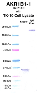 点击放大图像，使用CPTC-AKR1B1-1作为主要抗体对抗来自TK-10细胞的细胞裂解物（通道2）的Western Blot。还包括分子重量标准（通道1）和小鼠IgG控制（通道3）。