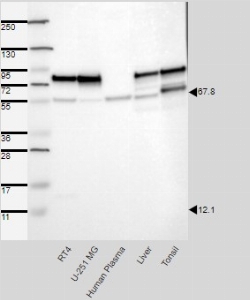 Click to enlarge image Results provided by the Human Protein Atlas (www.proteinatlas.org). Band of predicted size in kDa (+/-20%) with additional bands present. Analysis performed using a standard panel of samples. Antibody dilution: 1:500