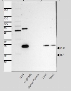 Click to enlarge image This PDF contains the evaluation results provided by the Human Protein Atlas (www.proteinatlas.org). Band of predicted size in kDa (+/-20%) with additional bands present.
Analysis performed using a standard panel of samples. Antibody Dilution 1:500