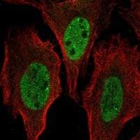 Click to enlarge image Results provided by the Human Protein Atlas (www.proteinatlas.org). The subcellular location is partly supported by literature or no literature is available. Immunofluorescent staining of human cell line U2OS shows localization to nucleoplasm.

	
Human assay: THP-1 fixed with PFA, dilution: 1:125
Human assay: U2OS fixed with PFA, dilution: 1:125