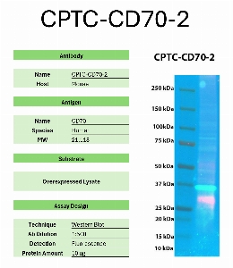 Click to enlarge image Western Blot of CPTC-CD70-2 against the over-expressed lysate of CD70. Expected MW is 21.1 KDa. The antibody detected the target protein.