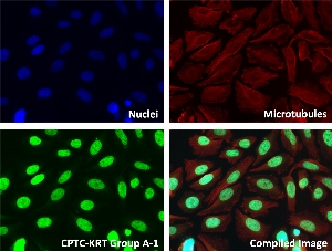 Click to enlarge image Immunofluorescence staining of human cell line HeLa with CPTC-KRT Group A-1 Ab shows localization to the nucleus, other.
