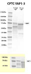Click to enlarge image Western blot using CPTC-YAP1-3 as primary antibody against recombinant human and mouse YAP1 protein (MYC-tagged) in over-expressed lysates. The antibody is able to detect the target protein in both species. The same MYC-tagged proteins were also tested with an anti-MYC antibody for MW validation.
