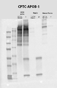 Click to enlarge image IP-WB performed with CPTC-APOB-1 antibody as capture antibody. Eluates were screened in WB using antibody CPTC-APOB-3 as detection antibody. CPTC-APOB-1 was able to pull down the native protein purified from human plasma and the protein in human plasma, however, does not show to be able to pull down the target in HepG2 lysate. APOB MW is 515 KDa.