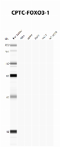 Click to enlarge image Automated Western Blot using CPTC-FOXO3-1 as primary antibody against cell lysates A549, H226, HeLa, Jurkat and MCF7. Expected MW of 71.3 KDa. All cell lysates negative.  Molecular weight standards are also included (lane 1).