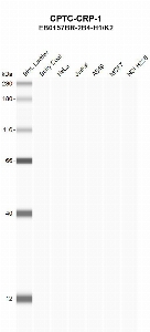 Click to enlarge image Automated western blot using CPTC-CRP-1 as primary antibody against buffy coat (lane 2), HeLa (lane 3), Jurkat (lane 4), A549 (lane 5), MCF7 (lane 6), and H226 (lane 7) whole cell lysates.  Expected molecular weight - 25.0 kDa and 10.4 kDa.  Molecular weight standards are also included (lane 1).