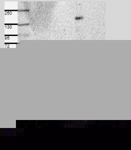 Click to enlarge image Results provided by the Human Protein Atlas (www.proteinatlas.org). Band of predicted size in kDa (+/-20%) with additional bands present. Analysis performed using a standard panel of samples. Antibody dilution: 1:500.