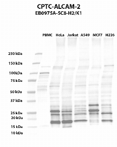 Click to enlarge image Western blot using CPTC-ALCAM-2 as primary antibody against PBMC (lane 2), HeLa (lane 3), Jurkat (lane 4), A549 (lane 5), MCF7 (lane 6), and NCI-H226 (lane 7) whole cell lysates.  Expected molecular weight - 65.1 kDa, 63.7 kDa, 15.1 kDa, and 33.9 kDa.  Molecular weight standards are also included (lane 1).